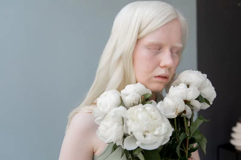 An albino woman peacefully holding a bouquet of white peonies indoors.